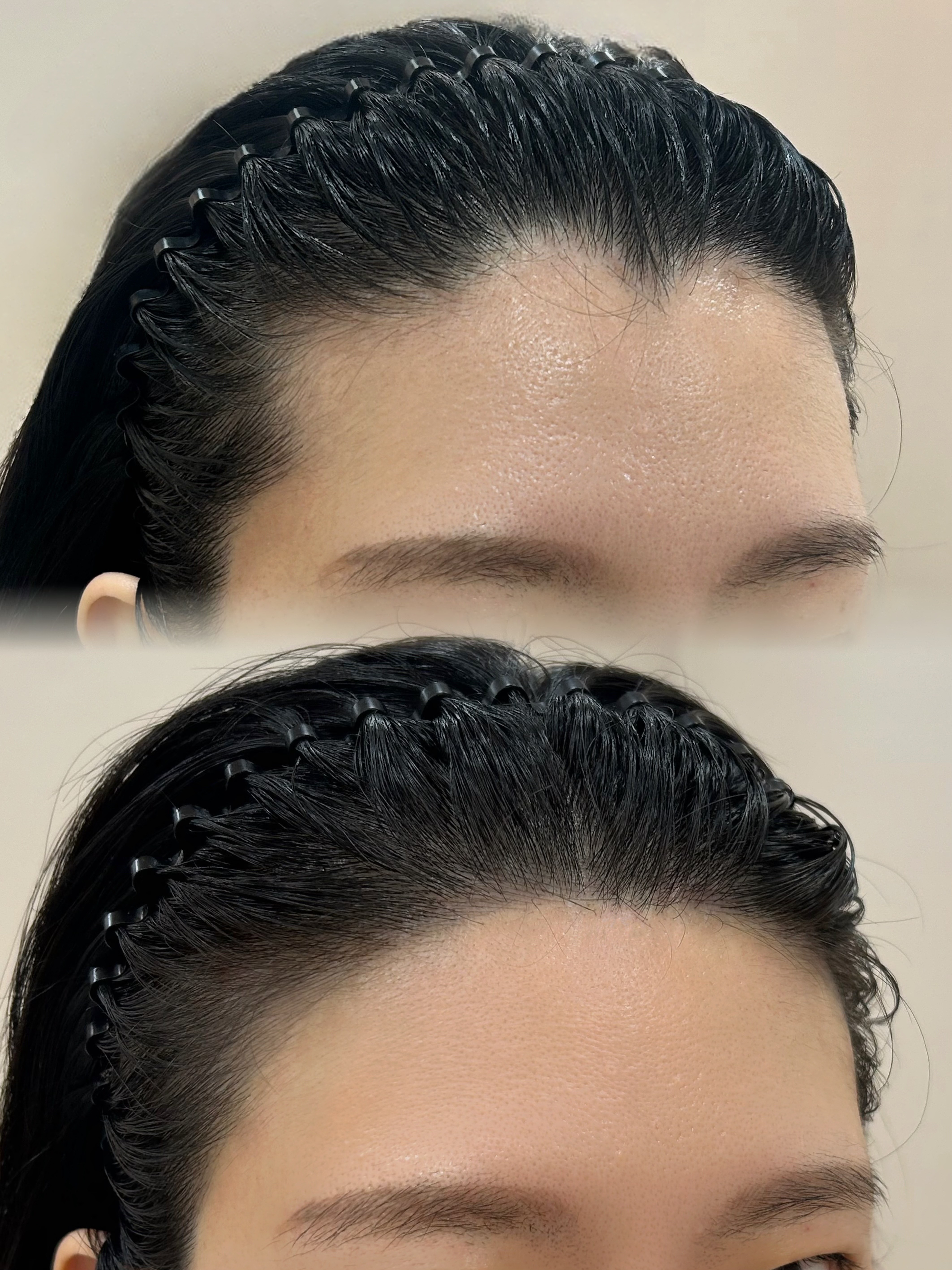 Before and after