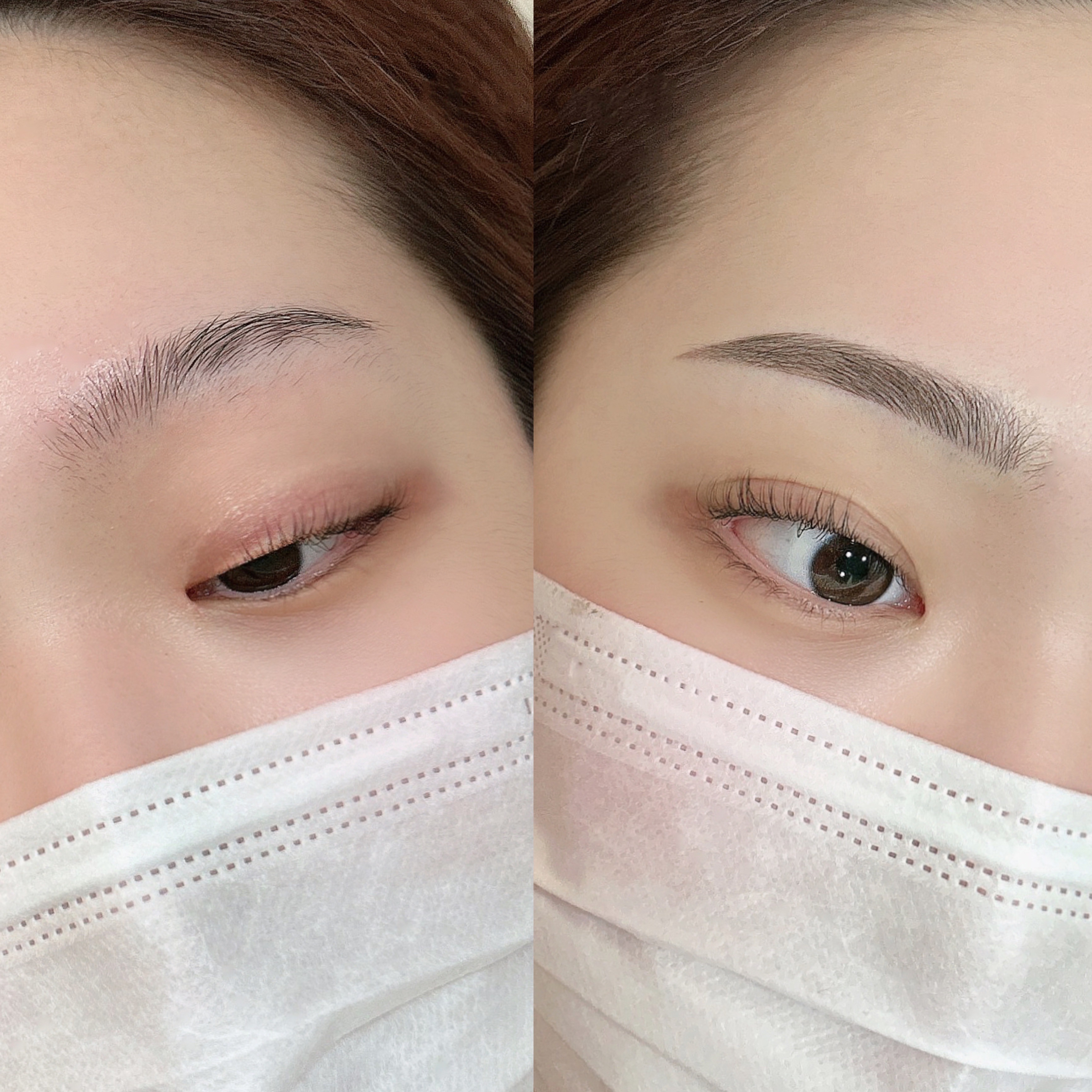 Before and after