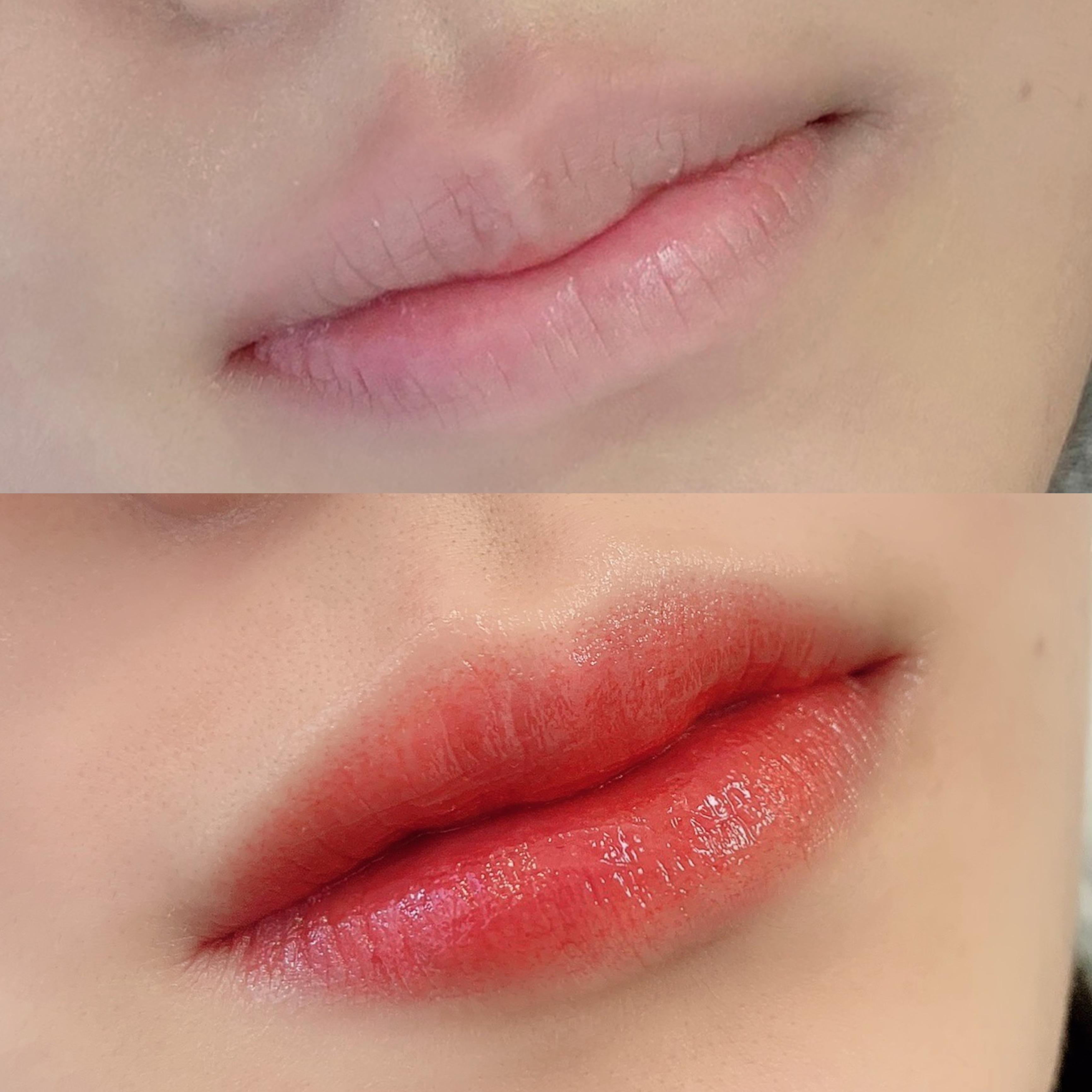 Before and after