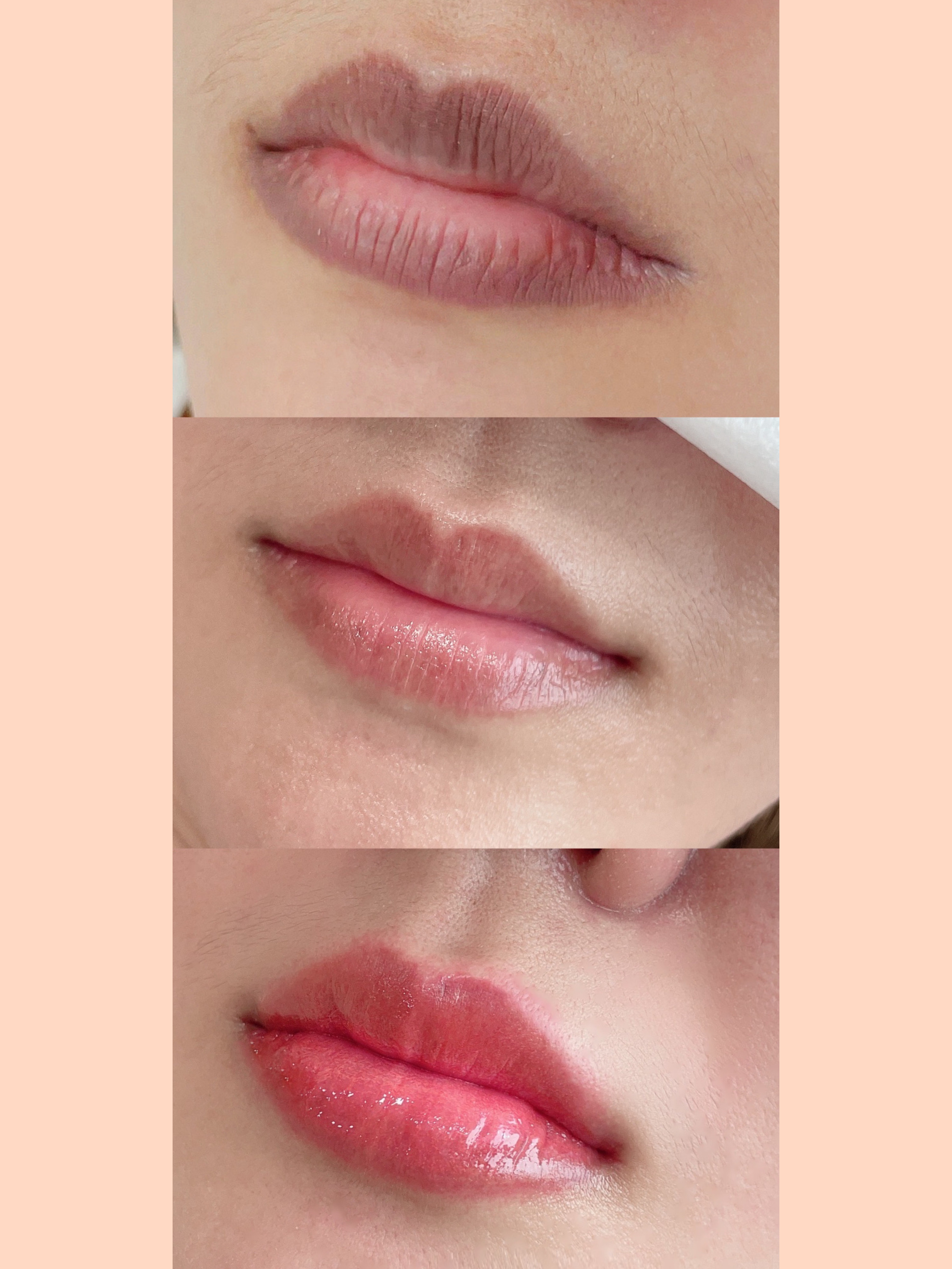 Before and after